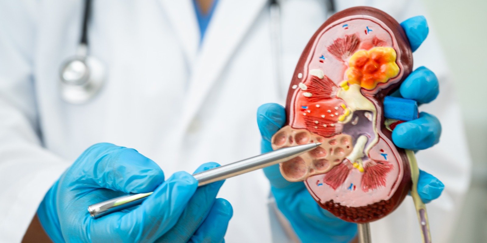 Nephrology Department