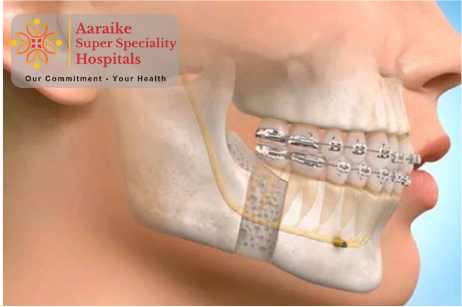 Oral & Maxillofacial Surgery: